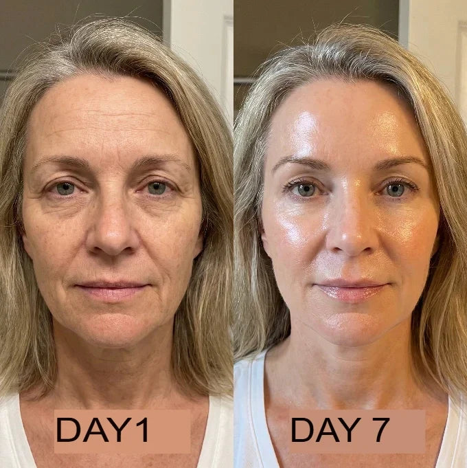 NutraSkin™ Collagen Oil | Tightens and lifts sagging skin by 98% within 24 hours