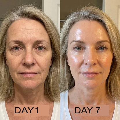 NutraSkin™ Collagen Oil | Tightens and lifts sagging skin by 98% within 24 hours