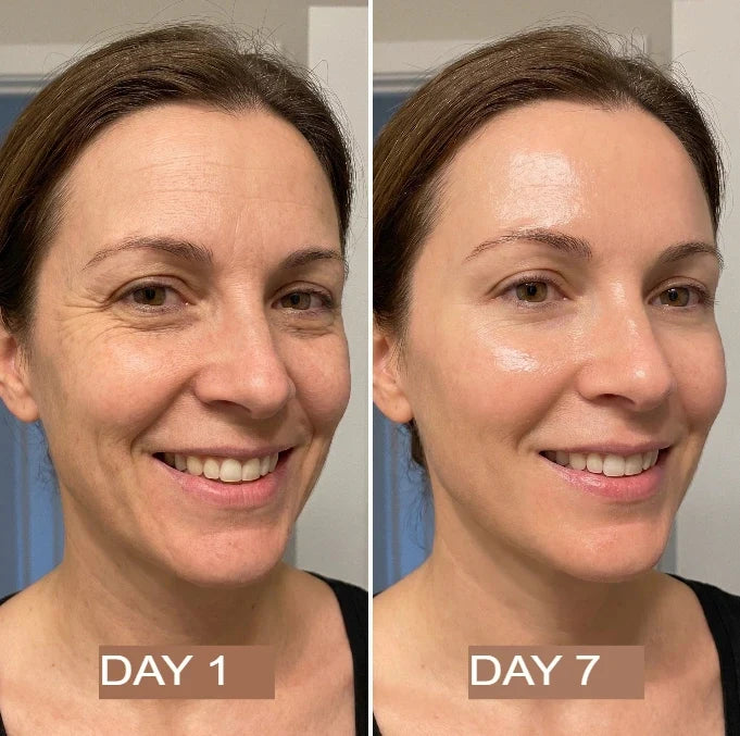 NutraSkin™ Collagen Oil | Tightens and lifts sagging skin by 98% within 24 hours
