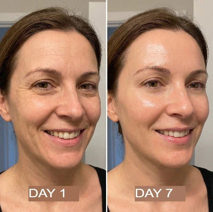 NutraSkin™ Collagen Oil | Tightens and lifts sagging skin by 98% within 24 hours