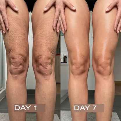 NutraSkin™ Collagen Oil | Tightens and lifts sagging skin by 98% within 24 hours