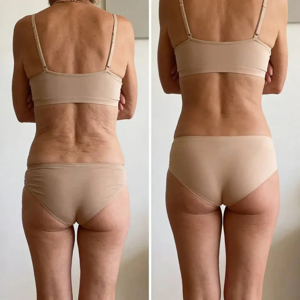 NutraSkin™ Collagen Oil | Tightens and lifts sagging skin by 98% within 24 hours